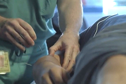 Dr. Lorimier performing acupuncture on a patient. 