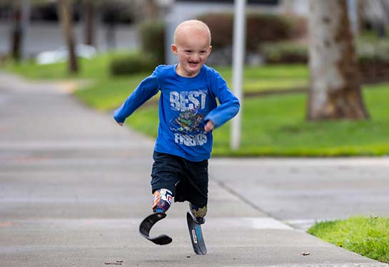 Boy with prosthetic legs running on a sidewalk