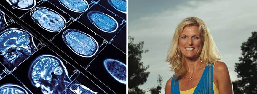 images of brain scans and woman smiling