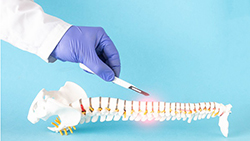 Gloved hand holding scalpel over model of spine