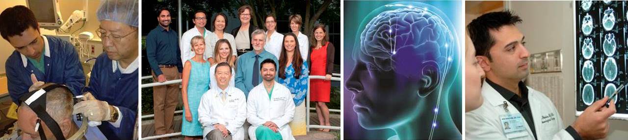 UC Davis Deep Brain Stimulation Program treats Parkinson's disease and essential tremor