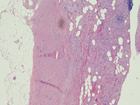 Microscopic image 4: Appendix (Click to enlarge)