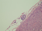 Microscopic image 9: Appendix (Click to enlarge)